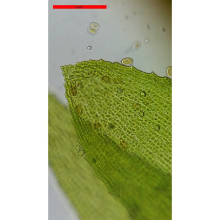 bresser-bino-40x-400x-professional-microscope_5